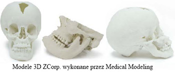Modele 3D ZCorp wykonane przez Medical Modeling